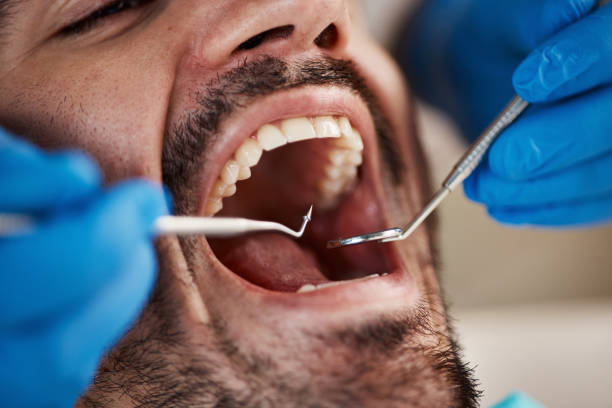 Best Emergency Root Canal Treatment in Ivins, UT