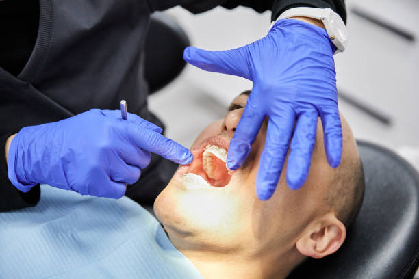 Best Emergency Dental Extractions in Ivins, UT
